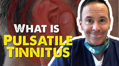 What Is Pulsatile Tinnitus Youtube