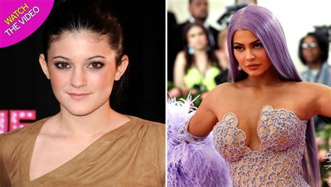 Inside Kylie Jenners £30k Body Overhaul As Surgeon Explains