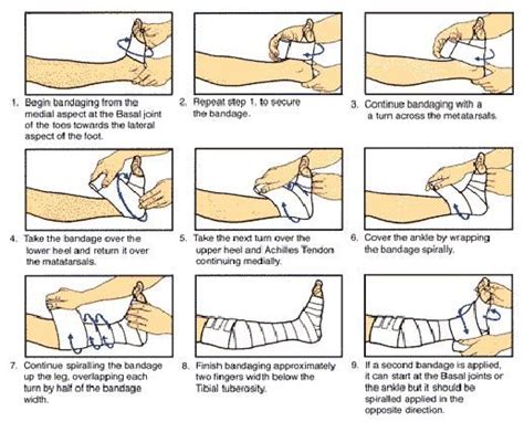 Bandaging Techniques Page Of Spiral Bandaging Techniques Surgical