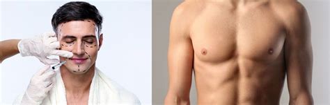 Las cinco opciones de cirugía estética más populares para hombres