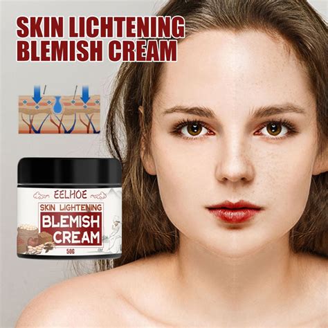 30g Powerful Whitening Freckle Cream Plant Serum Face Cream Remove Freckles And Dark Spots