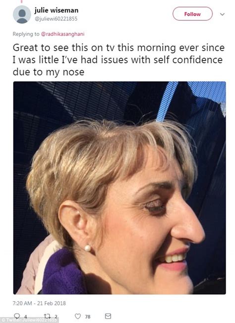 twitter users share photos of big noses to break the taboo daily mail online
