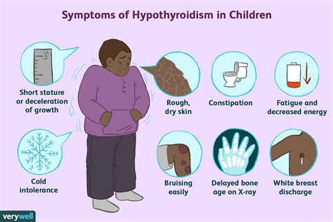 Thyroid Diseases As Related To Hyperthyroidism Pictures