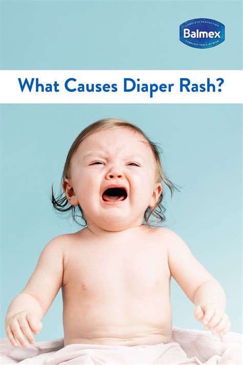 Pics Of Diaper Rash Understanding The Common Skin Condition In Babies