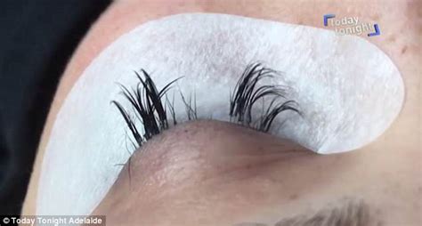 Adelaide Women Gets Serious Infection After Eyelash Extensions Daily