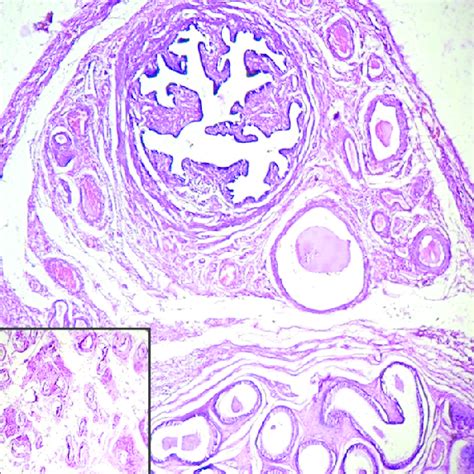 photomicrograph showing fallopian tube and epididymis side by side download scientific diagram