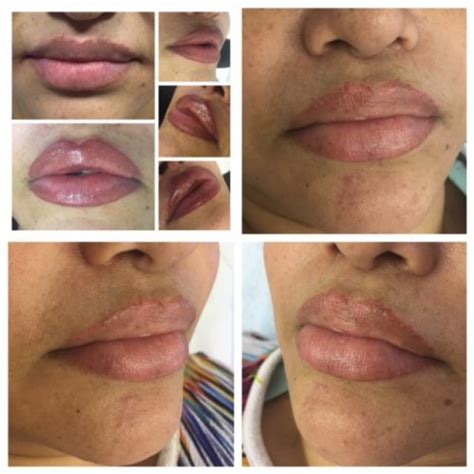 Healed Lip Blush Permanent Makeup Gemma Kennelly