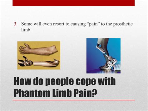 Ppt Phantom Limb Pain Powerpoint Presentation Free Download Id6859222