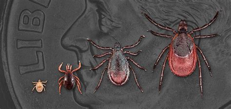 Cureus A Case Of Tick Bite Induced Babesiosis With Lyme Disease