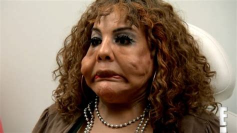 Transformation Cement Face Woman From Botched Debuts New Look