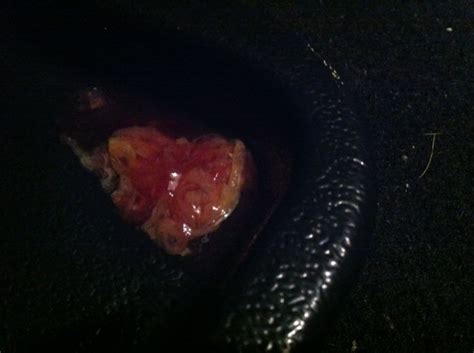 Check spelling or type a new query. + dog pooping blood mucus | COVID OUTBREAK