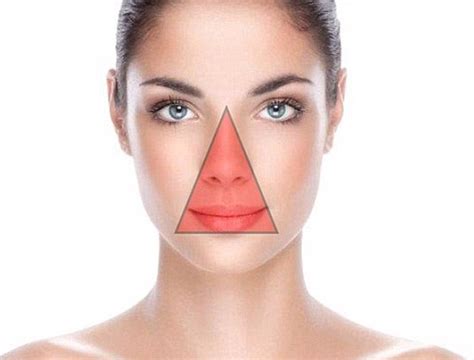 Why You Should Never Pop Or Pick At A Pimple In The Triangle Of Death