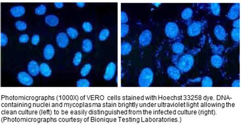 Mycoplasma Contamination Cell Culture