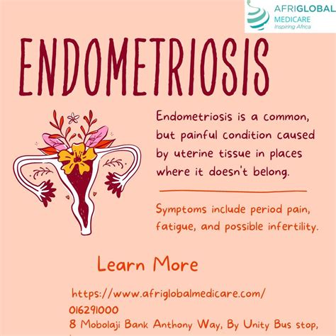 Endometriosis Symptoms Afriglobal Medium