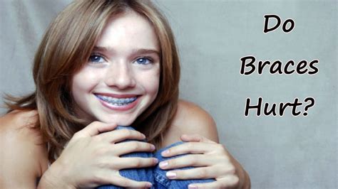 Do Braces Hurt How To Take Away The Pain Realtime Youtube Live View