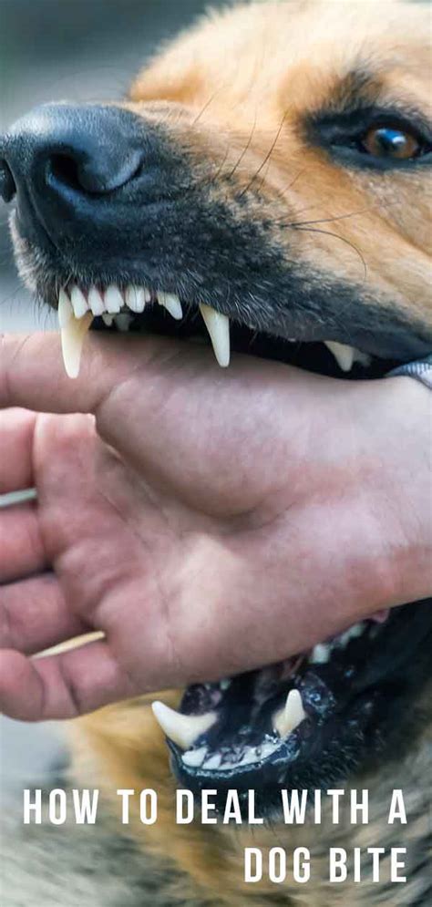 Dog Bite Treatment For Humans And Dogs