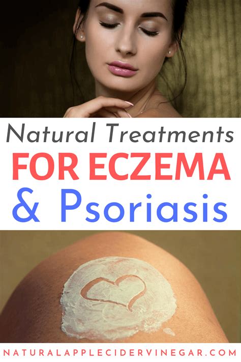 Top 5 Best Natural Treatments For Eczema And Psoriasis Psoriasis