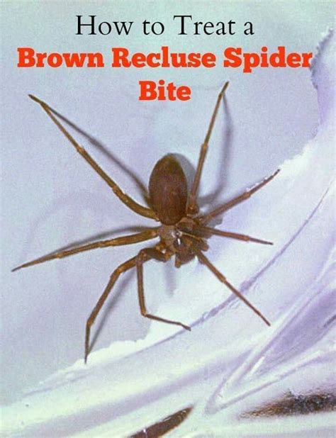 Brown Recluse Spider Bite Spider Identification Chart Spider Bite