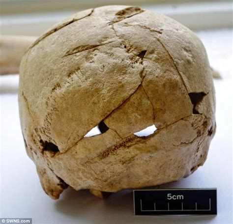 Eras Gone 1000 Year Old Saxon Skull Shows Six Sword Wounds