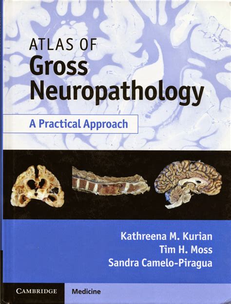 Neuropathology Blog Atlas Of Gross Neuropathology To Be Released In