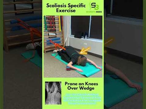 Scoliosis Specific Exercise Schroth Prone On Knees Over Wedge Youtube