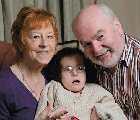 Mengenal 4 Macam Kelainan Trisomi Down Syndrome Itu Salah Satunya
