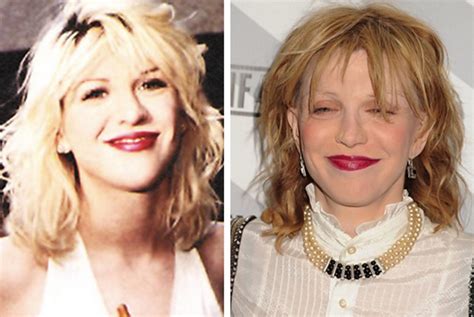 Shocking Photos Of Celebrities Before And After Drugs Trending News Labs