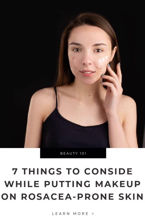 7 Things To Consider While Putting Makeup On Rosacea Prone Skin