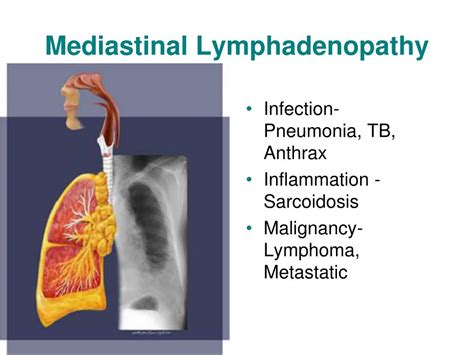 Ppt Mediastinal Syndromes Powerpoint Presentation Free Download Id