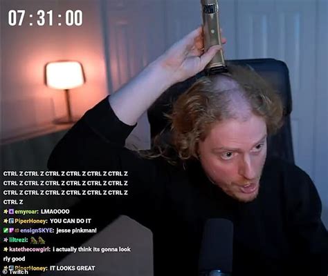 Twitch Gamers Get Indent On Head From Wearing Headphones For Hours