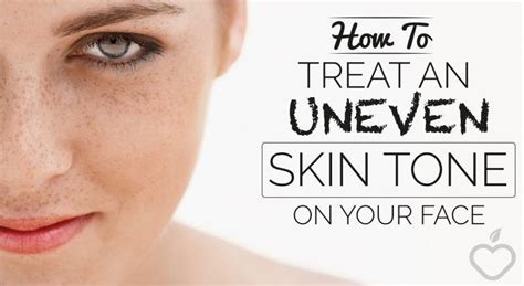 How To Treat An Uneven Skin Tone On Your Face