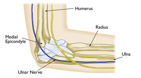 Ulnar Nerve Entrapment At The Elbow Cubital Tunnel Syndrome