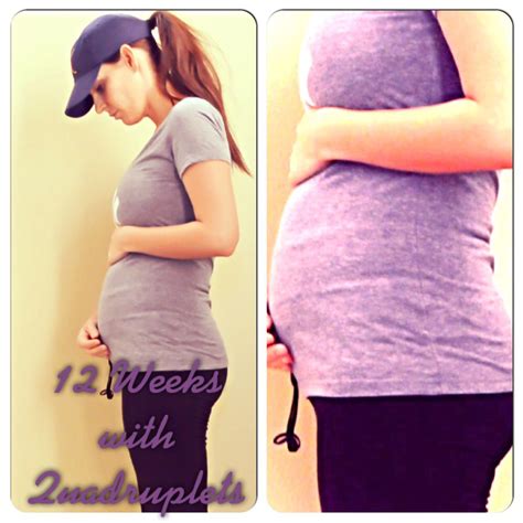 12 weeks pregnant with quads 12 weeks pregnant quadruplets pregnancy photos pencil skirt