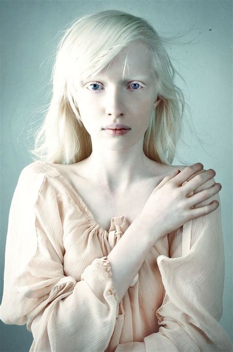 Untitled By Lena Dunaeva 500px Albino Model Albinism Albino