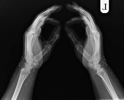Case 263 Radiology