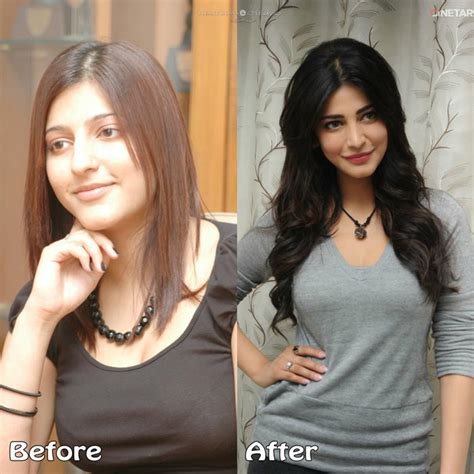 Top 10 Bollywood Plastic Surgeries Disasters Before And After Heart Bows And Makeup