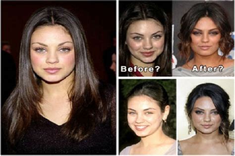 Mila Kunis Plastic Surgery Checklist Of Facts And Rumors Celebrity Measurements And Plastic Surgery