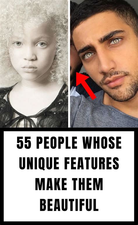 55 People Whose Unique Features Make Them Stunningly Beautiful
