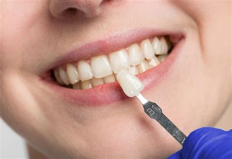 Markic Dental Mississauga Ontario Dentistmarkic Dental Dentist