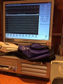 24 Hour Holter Monitoring Peter Yan Cardiology Clinic