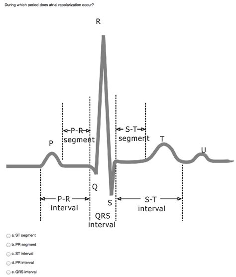 Solved During Which Period Does Atrial Repolarization Occur Chegg Com