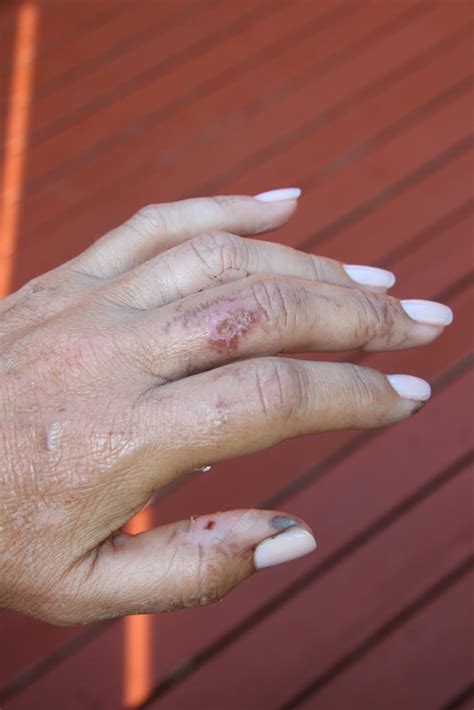 Maybe something is off chemically that encourages their. Sarchet Family Blog: Soccer- Airsoft Guns-Hand update :-)