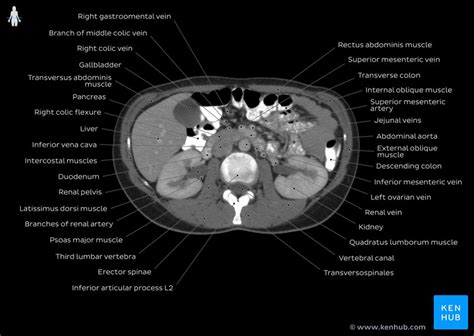 A collection of data interpretation guides to help you learn how to interpret various laboratory and radiology investigations. Radiological anatomy : X-ray, CT, MRI | Kenhub