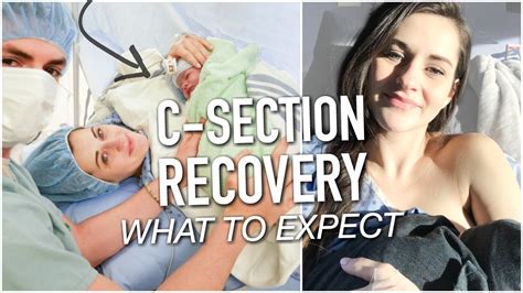 Excessive Bleeding After C Section Designatorsperplexity