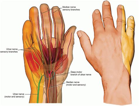 Ultrasound Guided Injection Technique For Ulnar Tunnel Syndrome