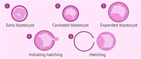Grades Of Expansion Of A Blastocyst