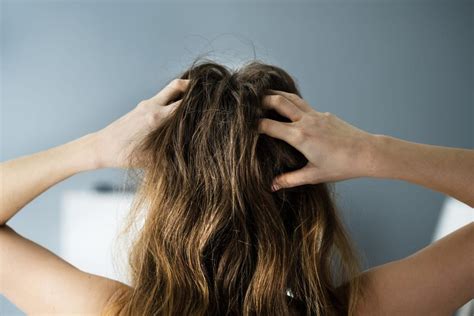 Six Reasons Why Your Scalp Might Be So Itchy