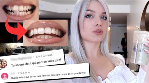J Ai Refait Mes Dents Cause Des Haters Sans Appareil Youtube