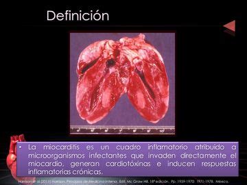 Aprenda sobre los síntomas, el diagnóstico y el tratamiento de la miocarditis. Miocarditis en perros - EcuRed
