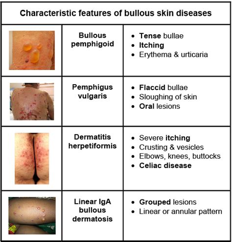 These Diseases Cannot Be Diagnosed Clinically Confirmation Is With